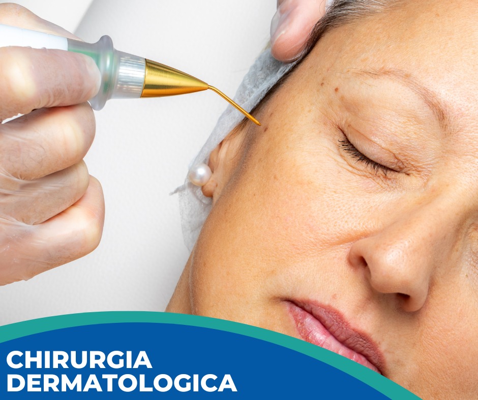 chirurgia dermatologica